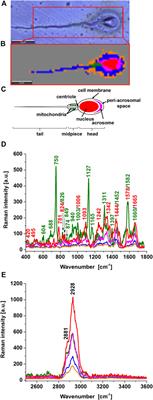 Decoding the role of cytochrome c in metabolism of human spermatozoa by Raman imaging